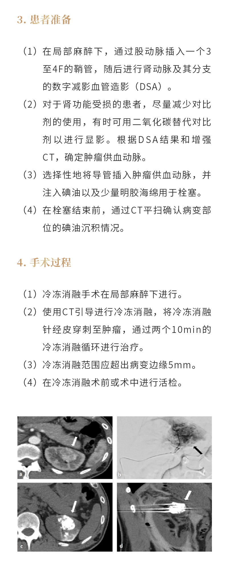 PCkpnFfMXONTpFo34EcX1TJt5aszN4HhMTg5LPoi